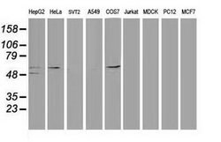 p53 Mouse anti-Human, Clone: OTI1C6, lyophilized, TrueMAB 100 &mu;g; Unconjugated:Antibodies,
