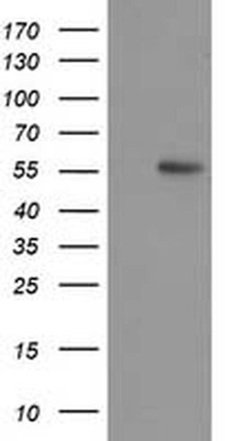 p53 Monoclonal Antibody (OTI2E4), TrueMAB , OriGene:Antibodies:Primary