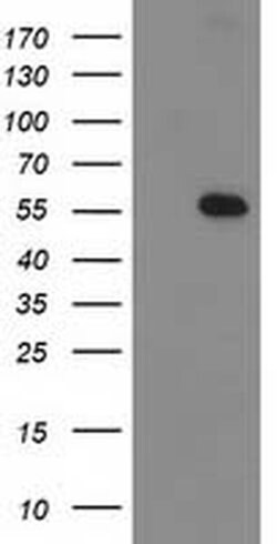 p53 Monoclonal Antibody (OTI3G9), TrueMAB , OriGene 100 &mu;L; Unconjugated:Antibodies,