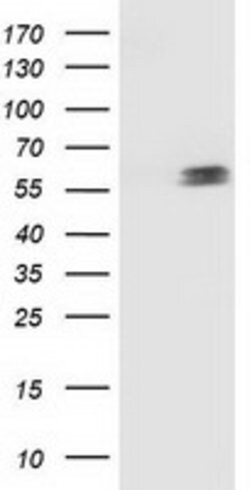 p53 Mouse anti-Human, Clone: OTI2F7, lyophilized, TrueMAB 100 &mu;g; Unconjugated:Antibodies,