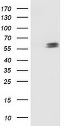 p53 Monoclonal Antibody (OTI2F7), TrueMAB , OriGene 30 &mu;L; Unconjugated:Antibodies,