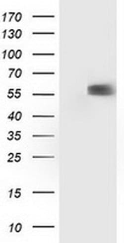 p53 Monoclonal Antibody (OTI1F4), TrueMAB , OriGene:Antibodies:Primary