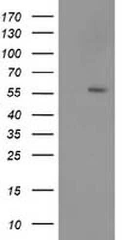p53 Monoclonal Antibody (OTI1D8), TrueMAB , OriGene 100 &mu;L; Unconjugated:Antibodies,