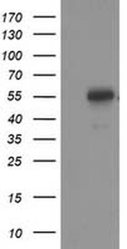 p53 Monoclonal Antibody (OTI5B2), TrueMAB , OriGene 100 &mu;L; Unconjugated:Antibodies,