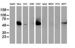 p53 Monoclonal Antibody (OTI5B2), TrueMAB , OriGene:Antibodies:Primary