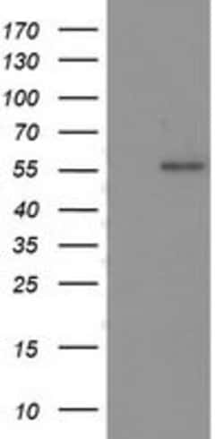 p53 Mouse anti-Human, Clone: OTI3A6, lyophilized, TrueMAB 100 &mu;g; Unconjugated:Antibodies,