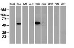 p53 Mouse anti-Human, Clone: OTI3A6, lyophilized, TrueMAB 100 &mu;g; Unconjugated:Antibodies,
