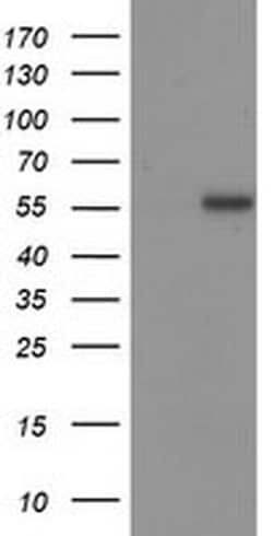 p53 Monoclonal Antibody (OTI2H4), TrueMAB , OriGene 100 &mu;L; Unconjugated:Antibodies,