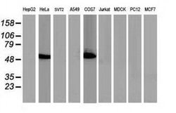 p53 Monoclonal Antibody (OTI2H4), TrueMAB , OriGene 100 &mu;L; Unconjugated:Antibodies,
