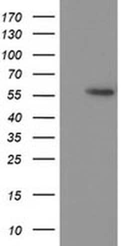 p53 Monoclonal Antibody (OTI1D11), TrueMAB , OriGene 30 &mu;L; Unconjugated:Antibodies,