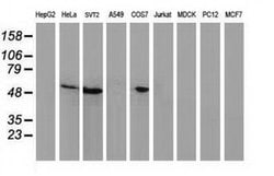 p53 Monoclonal Antibody (OTI1D11), TrueMAB , OriGene 30 &mu;L; Unconjugated:Antibodies,