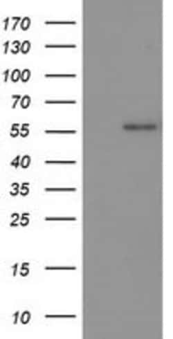 p53 Mouse anti-Human, Clone: OTI1E1, lyophilized, TrueMAB 100 &mu;g; Unconjugated:Antibodies,