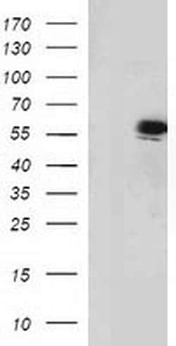 p53 Monoclonal Antibody (OTI1D1), TrueMAB , OriGene 100 &mu;L; Unconjugated:Antibodies,
