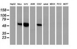p53 Monoclonal Antibody (OTI1D1), TrueMAB , OriGene 100 &mu;L; Unconjugated:Antibodies,