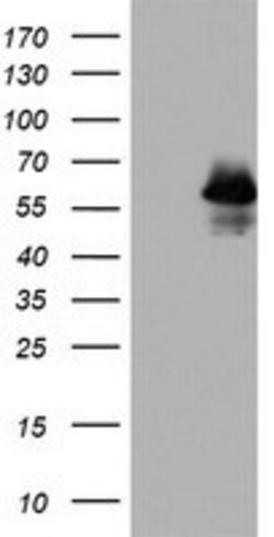 p53 Mouse anti-Human, Clone: OTI7E2, lyophilized, TrueMAB 100 &mu;g; Unconjugated:Antibodies,