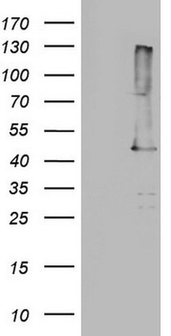 p53 Mouse anti-Human, Clone: DO-1, lyophilized, TrueMAB 100 &mu;g; Unconjugated:Antibodies,