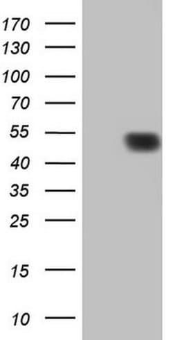 p53 Monoclonal Antibody (OTI5B1), TrueMAB , OriGene 30 &mu;L; Unconjugated:Antibodies,