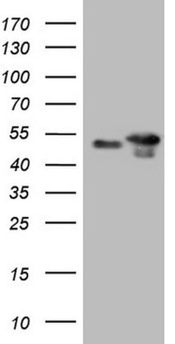 p53 Mouse anti-Human, Clone: OTI6C3, lyophilized, TrueMAB 100 &mu;g; Unconjugated:Antibodies,