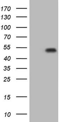 p53 Monoclonal Antibody (OTI6C1), TrueMAB , OriGene 100 &mu;L; Unconjugated:Antibodies,