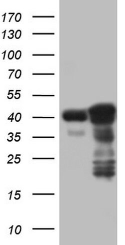 p53 Mouse anti-Human, Clone: OTI7A11, lyophilized, TrueMAB 100 &mu;g; Unconjugated:Antibodies,