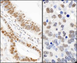 Phospho-53BP1 (Ser25) Rabbit anti-Human, Mouse, Polyclonal, Bethyl Laboratories