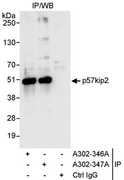 p57kip2 Rabbit anti-Human, Polyclonal, Bethyl Laboratories 100 &mu;L; Unconjugated:Antibodies,