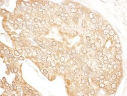 p600 Rabbit anti-Human, Polyclonal, Bethyl Laboratories 100 &mu;L | Buy Online | Bethyl Laboratories, Inc | Fisher Scientific