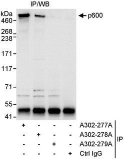 p600 Rabbit anti-Human, Polyclonal, Bethyl Laboratories 10 &mu;L; Unconjugated:Antibodies,