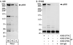 p600 Rabbit anti-Human, Mouse, Polyclonal, Bethyl Laboratories 100 &mu;L;