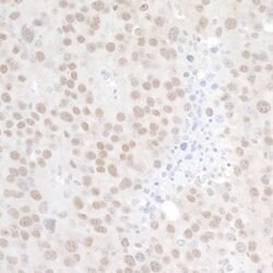 p66alpha Rabbit anti-Human, Mouse, Polyclonal, Bethyl Laboratories 100