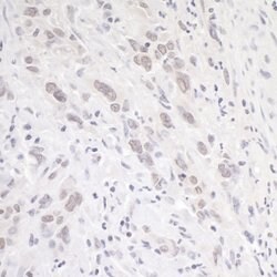 p66alpha Rabbit anti-Human, Mouse, Polyclonal, Bethyl Laboratories 100