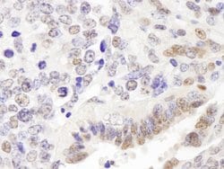 p66alpha Polyclonal Antibody, Bethyl Laboratories 100 &mu;l; Unlabeled:Antibodies,