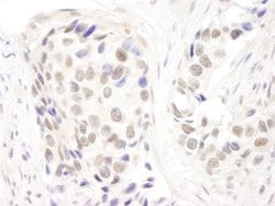 p66alpha Polyclonal Antibody, Bethyl Laboratories 100 &mu;l; Unlabeled:Antibodies,