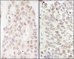 p66beta/GATAD2B Rabbit anti-Human, Mouse, Polyclonal, Bethyl Laboratories