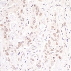 p66beta/GATAD2B Rabbit anti-Human, Polyclonal, Bethyl Laboratories 10 &mu;L;