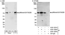 p66beta/GATAD2B Rabbit anti-Human, Mouse, Polyclonal, Bethyl Laboratories