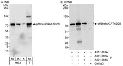 p66beta/GATAD2B Rabbit anti-Human, Mouse, Polyclonal, Bethyl Laboratories