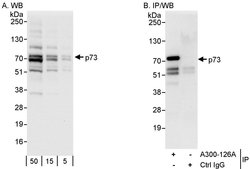 p73 Rabbit anti-Human, Polyclonal, Bethyl Laboratories 100 &mu;L; Unconjugated:Antibodies,