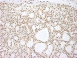 p73 Polyclonal Antibody, Bethyl Laboratories 10 &mu;L; Unconjugated:Antibodies,
