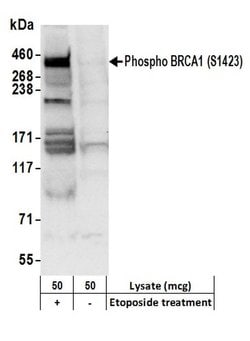 Phospho-BRCA1 (Ser1423) Rabbit anti-Human, Polyclonal, Bethyl Laboratories