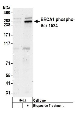 Phospho-BRCA1 (Ser1524) Rabbit anti-Human, Polyclonal, Bethyl Laboratories