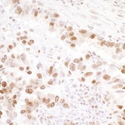 Phospho-KAP-1 (Ser824) Recombinant Rabbit Monoclonal Antibody (BL-246-7B5),