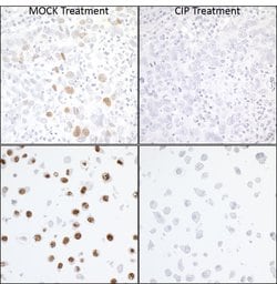 Phospho-KAP-1 (Ser824) Recombinant Rabbit Monoclonal Antibody (BL-246-7B5),