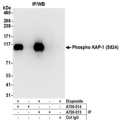 Phospho-KAP-1 (Ser824) Recombinant Rabbit Monoclonal Antibody (BL-246-7B5),