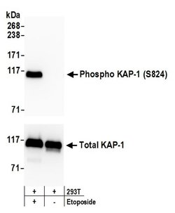 Phospho-KAP-1 (Ser824) Recombinant Rabbit Monoclonal Antibody (BL-246-7B5),