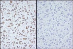 Phospho-SMC1 (Ser966) Polyclonal Antibody, Bethyl Laboratories 10 &mu;L | Buy Online | Bethyl Laboratories, Inc | Fisher Scientific