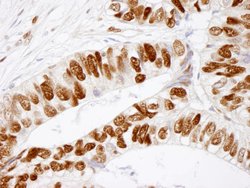 Phospho-MCM2 (Ser41) Polyclonal Antibody, Bethyl Laboratories 10 &mu;L;