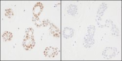 Phospho-PCNA (Tyr211) Polyclonal Antibody, Bethyl Laboratories 10 &mu;L;