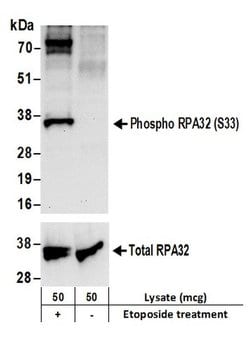 Phospho-RPA32 (Ser33) Rabbit anti-Human, Polyclonal, Bethyl Laboratories