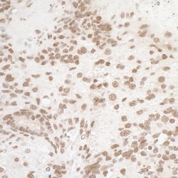 Phospho-RPA32 (Ser4, Ser8) Rabbit anti-Human, Mouse, Polyclonal, Bethyl